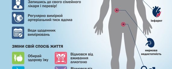 Pressure A3 Print(curvs)